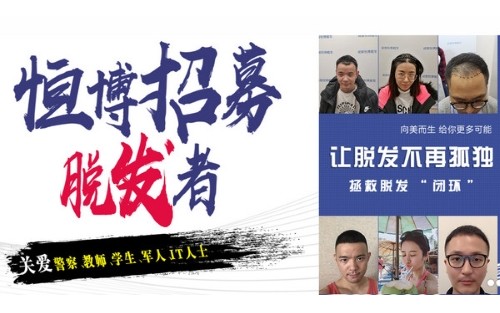 成都恒博植發(fā)醫(yī)院