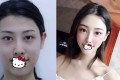 四川美萊醫(yī)學(xué)美容醫(yī)院熊猛醫(yī)生怎么樣