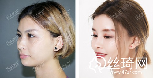 北京禾美嘉醫(yī)療美容怎么樣內附2019全新價格表