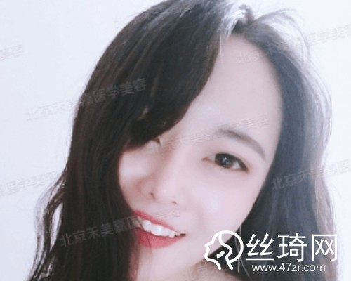 北京禾美嘉醫(yī)療美容自體脂肪填充面部那個醫(yī)生好？