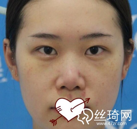 成都恒博醫(yī)院李烈醫(yī)生怎么樣？