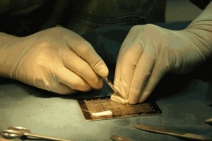 玻尿酸隆鼻也有被嫌棄的時候，你該怎么選?
