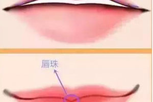 迷死人的微笑唇究竟是怎么做的？玻尿酸豐唇果好不好