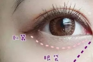 這3個(gè)溝不解決，永遠(yuǎn)顯老！