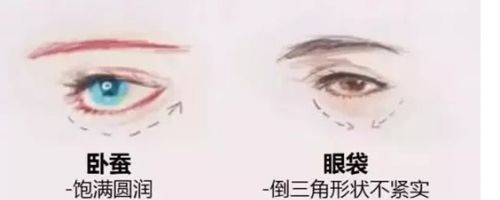 玻尿酸注射『臥蠶』，你需要嗎？