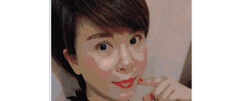 深圳藝星整形醫(yī)生常德成：她脂肪填充后，臉居然變小了？