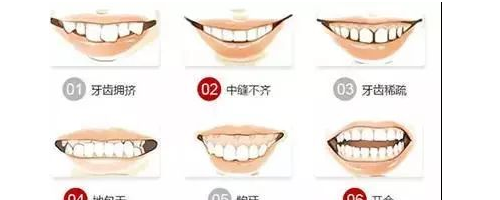 為什么牙齒矯正這么貴？