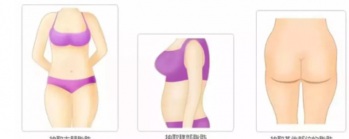 科普你真的了解自體脂肪填充么？