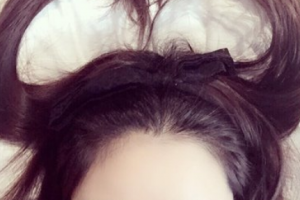 腿部吸脂了解一下！