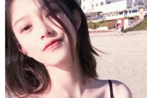 武警上?？傟?duì)醫(yī)院整形美容中心周志綱整形價(jià)格表附雙眼皮案例展示