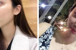上海天大醫(yī)療美容醫(yī)院陳守正整形價格表附祛斑案例展示