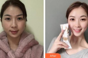 上海天大醫(yī)療美容醫(yī)院張敏華皮膚美容學(xué)專家整形價(jià)格表附[激光美膚祛斑]多方面部激光美膚祛斑案例展示