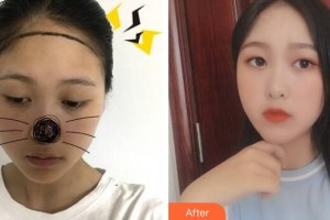 廣州樂(lè)鬢毛發(fā)移植中心計(jì)斌整形價(jià)格表附發(fā)際線案例展示