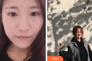 上海玫瑰醫(yī)療美容醫(yī)院吳曉麗整形價(jià)格表附無針?biāo)獍咐故?>
</a>
<h3 class=