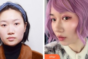 廣州美萊醫(yī)療美容醫(yī)院金憲俊整形價(jià)格表附埋線雙眼皮+去脂案例展示