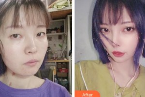 上?，旣愥t(yī)院整形美容中心李云天主診醫(yī)師整形價格表附皮膚清潔補(bǔ)水嫩膚案例展示