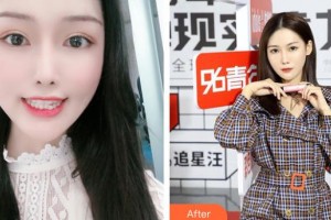 上海港華醫(yī)療美容醫(yī)院朱根定整形價(jià)格表附牙齒做美容案例展示