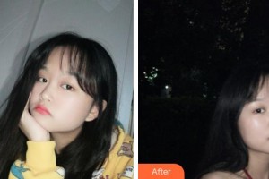 武警上?？傟?duì)醫(yī)院整形美容中心朱麗倩整形價(jià)格表附光子嫩膚案例展示