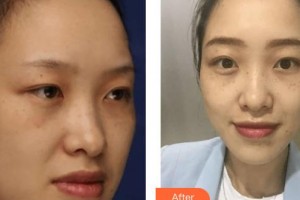 上海復(fù)麗醫(yī)療美容門診部林繡諭整形價(jià)格表附激光祛斑案例展示