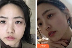 上海光博士醫(yī)療美容門診部張健整形價(jià)格表附超激光美膚祛雀斑曬斑案例展示
