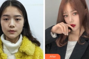 上海凱渥醫(yī)療美容門診部陳小萱整形價(jià)格表附美鼻部手術(shù)案例展示