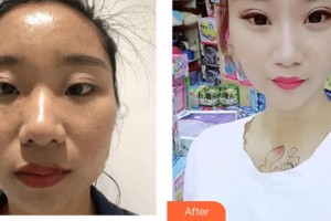 上海美未央醫(yī)療美容門診部劉堯整形價(jià)格表附牙齒矯正案例展示