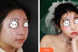 上海伊萊美醫(yī)療美容醫(yī)院Dr.Li整形價(jià)格表附鼻部綜合案例展示