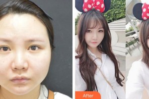 合肥劉大夫美容整形醫(yī)院金問(wèn)正整形價(jià)格表附面部輪廓案例展示