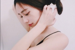 南京藍(lán)鱘口腔醫(yī)院王美玲整形價(jià)格表附種植牙案例展示