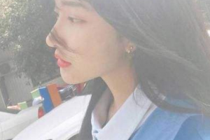 北京賽德陽光口腔門診部劉偉濤整形價格表附美白貼片案例展示