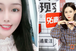南京博韻口腔門診部丁冬梅整形價格表附金屬托槽矯正案例展示