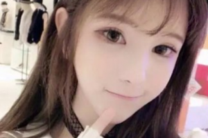 江西博愛眼科醫(yī)院陳小娟整形價(jià)格表附切開雙眼皮案例展示