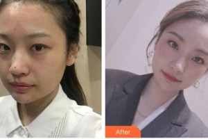 成都素美醫(yī)療美容診所范瓅月整形價格表附超激光美膚祛斑嫩膚案例展示