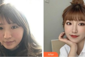 成都艾尚醫(yī)學美容門診部江海燕整形價格表附超激光美膚美白嫩膚案例展示