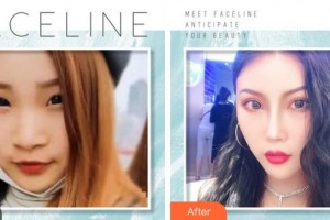 成都金榮醫(yī)學美容診所張松林整形價格表附吸脂案例展示