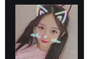 深圳蒳美邇醫(yī)療美容醫(yī)院雷曼蘋(píng)整形價(jià)格表附光子嫩膚案例展示