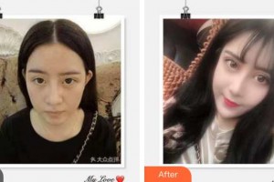 成都圣形醫(yī)療美容診所陳強整形價格表附眼部整形案例展示