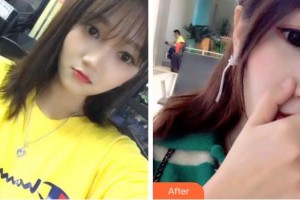 成都純?？谇辉\所劉純虎整形價(jià)格表附超聲波潔牙案例展示
