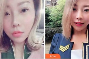 福州新時代醫(yī)療美容門診部肖逸整形價格表附牙齒隱形矯正案例展示