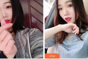 福州愛尚貝臣口腔門診部穆素花整形價格表附超聲波潔牙案例展示