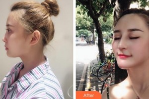 董新整形價格表附活力少女速成寶典案例展示