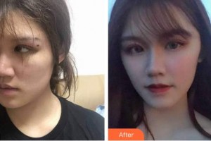 廈門銀河整形美容醫(yī)院孫玉香整形價(jià)格表附抗衰案例展示