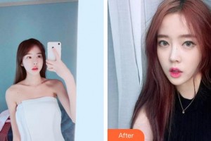 廈門蔡懿醫(yī)療美容診所李慧善整形價格表附鼻部手術(shù)案例展示