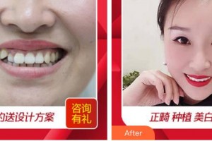 廈門卓爾口腔門診部蘇煉強(qiáng)整形價格表附隱形矯正案例展示