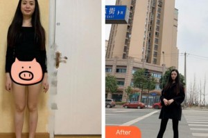 南平時(shí)光醫(yī)療美容門診部朱園靜整形價(jià)格表附吸脂瘦大腿案例展示