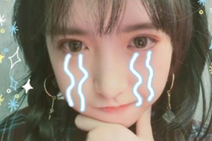 西安航天總醫(yī)院眼科文先環(huán)整形價(jià)格表附下瞼整形案例展示