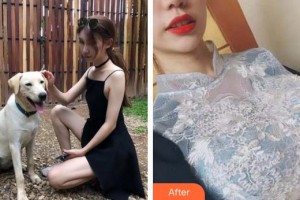 合肥恒美整形醫(yī)院趙佳鳳整形價格表附假體隆胸案例展示