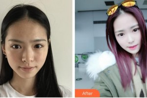 合肥壹加壹整形美容醫(yī)院柳春洙整形價格表附抗衰老案例展示