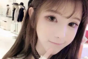 西安貝巢口腔診所常鳳整形價格表附切開雙眼皮案例展示