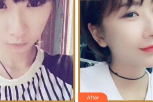 合肥名人眼科醫(yī)院曾令輝整形價(jià)格表附眼部綜合案例展示